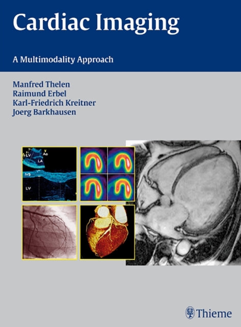 Cardiac Imaging: A Multimodality Approach