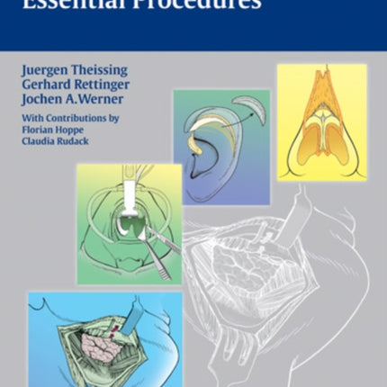 ENT Head and Neck Surgery: Essential Procedures