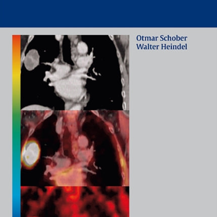 PET-CT Hybrid Imaging