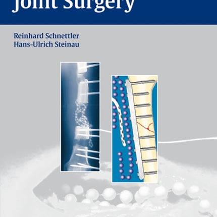 Septic Bone and Joint Surgery