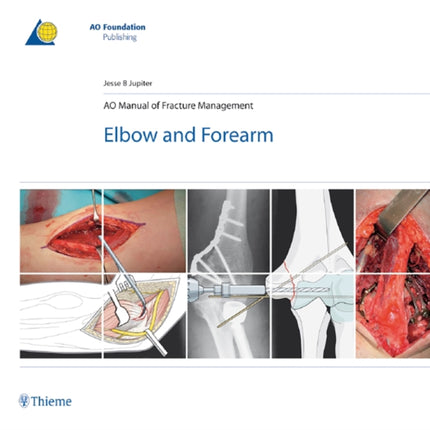 AO Manual of Fracture Management - Elbow & Forearm