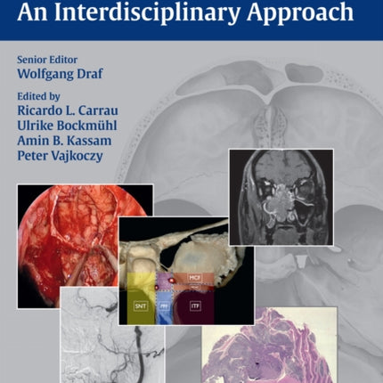 Endonasal Endoscopic Surgery of Skull Base