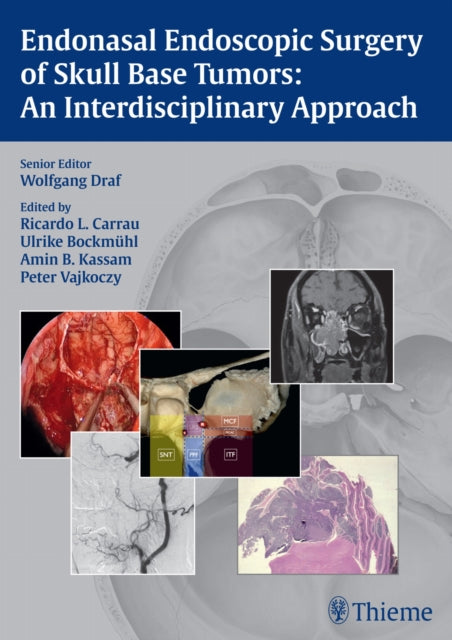 Endonasal Endoscopic Surgery of Skull Base