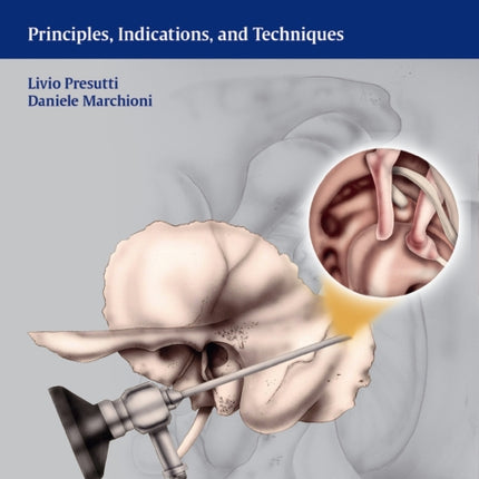 Endoscopic Ear Surgery: Principles, Indications, and Techniques