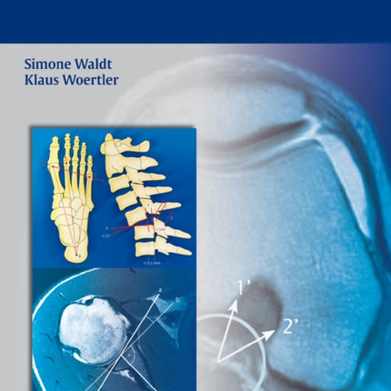 Measurements and Classifications in Musculoskeletal Radiology