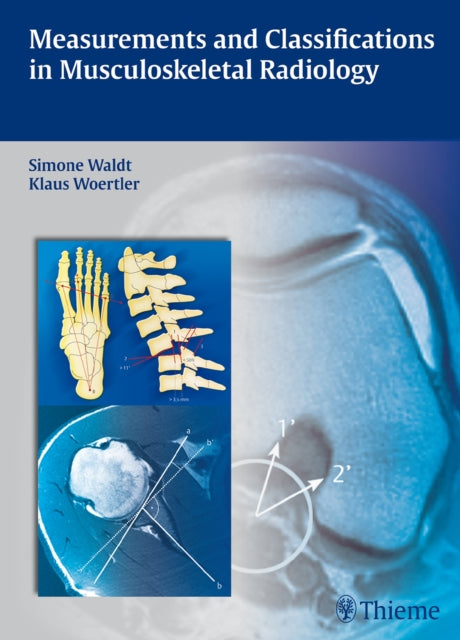 Measurements and Classifications in Musculoskeletal Radiology