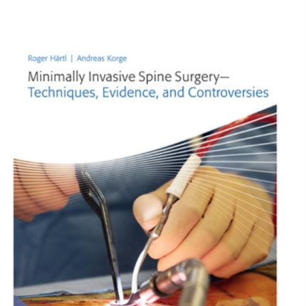 Minimally Invasive Spine Surgery - Techniques, Evidence, and Controversies