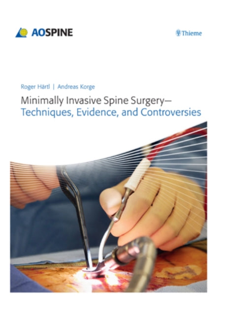 Minimally Invasive Spine Surgery - Techniques, Evidence, and Controversies