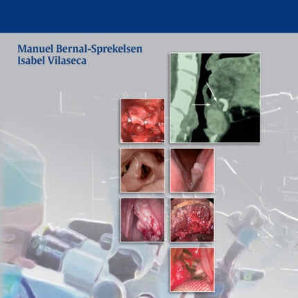 Transoral Laser Microsurgery of Benign and Malignant Lesions