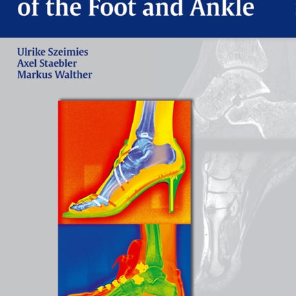 Diagnostic Imaging of the Foot and Ankle