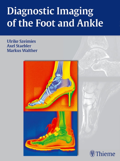 Diagnostic Imaging of the Foot and Ankle