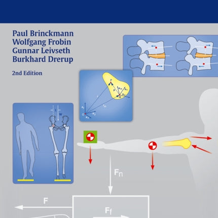 Orthopedic Biomechanics