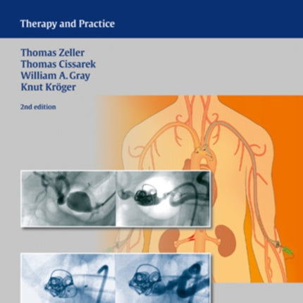 Vascular Medicine: Therapy and Practice