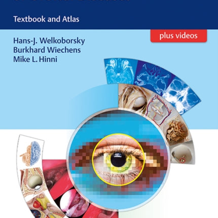 Interdisciplinary Management of Orbital Diseases: Textbook and Atlas