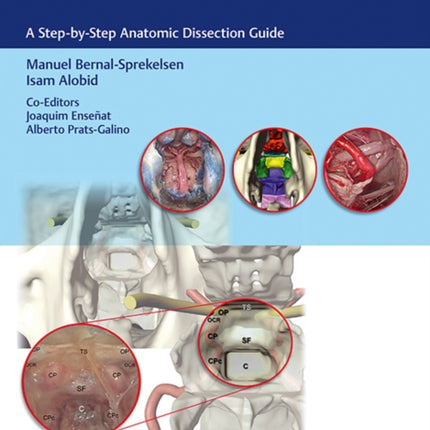 Endoscopic Approaches to the Paranasal Sinuses