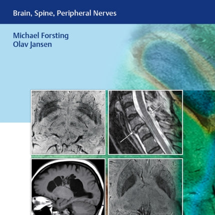 MR Neuroimaging: Brain, Spine, Peripheral Nerves