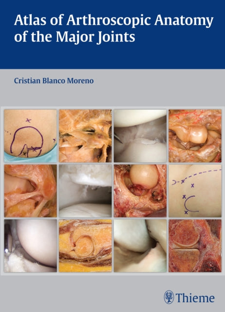 Atlas of Arthroscopic Anatomy of the Major Joints