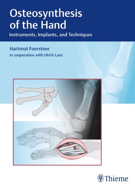 Osteosynthesis of the Hand: Instruments, Implants, and Techniques