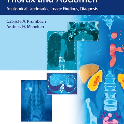 Body Imaging Thorax and Abdomen