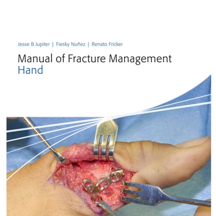 Manual of Fracture Management - Hand