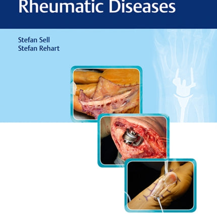 Surgery for Rheumatic Diseases