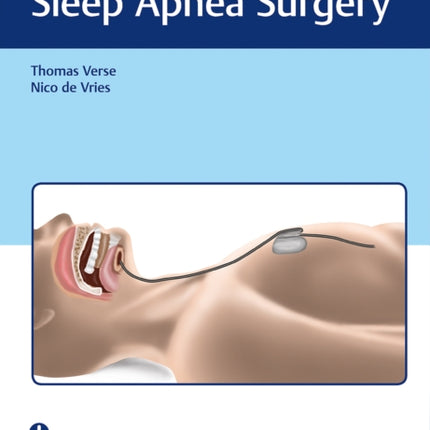 Current Concepts of Sleep Apnea Surgery