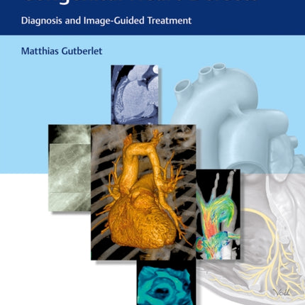 Diagnostic Imaging of Congenital Heart Defects