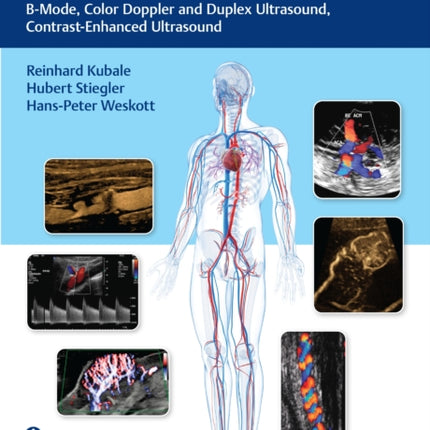 Vascular Ultrasound  BMode Color Doppler and