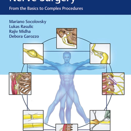 Manual of Peripheral Nerve Surgery: From the Basics to Complex Procedures