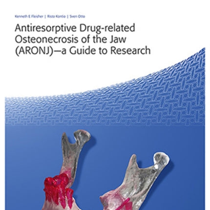 Antiresorptive Drug-Related Osteonecrosis of the Jaw (ARONJ) - A Guide to Research