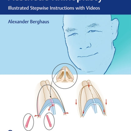 Manual of Functional and Aesthetic Rhinoplasty