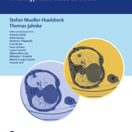 Complications in Nonvascular Interventional Therapy and Interventional Oncology Casebased Solutions