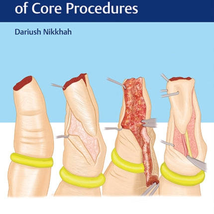 Hand Trauma: Illustrated Surgical Guide of Core Procedures