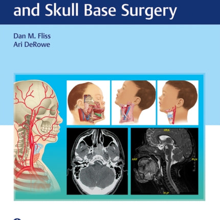 Atlas of Pediatric Head and Neck and Skull Base Surgery