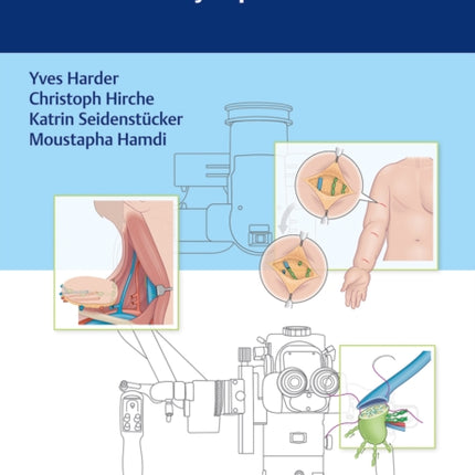 Modern Surgical Management of Chronic Lymphedema