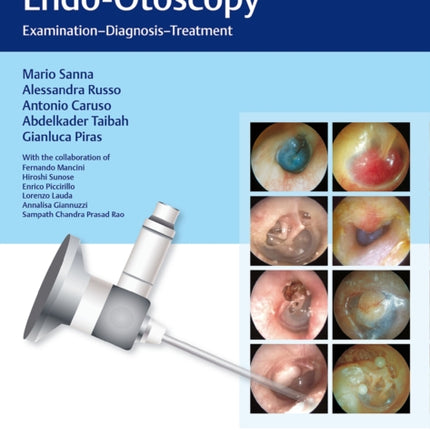 Color Atlas of Endo-Otoscopy: Examination - Diagnosis - Treatment