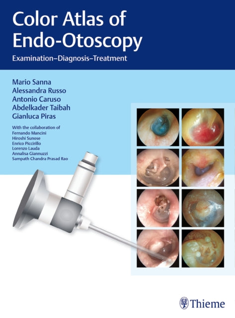 Color Atlas of Endo-Otoscopy: Examination - Diagnosis - Treatment