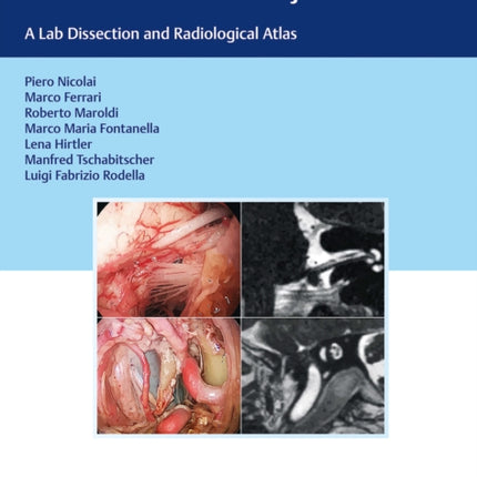 Endoscopic Transnasal Anatomy of the Skull Base and Adjacent Areas