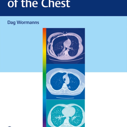 Diagnostic Imaging of the Chest