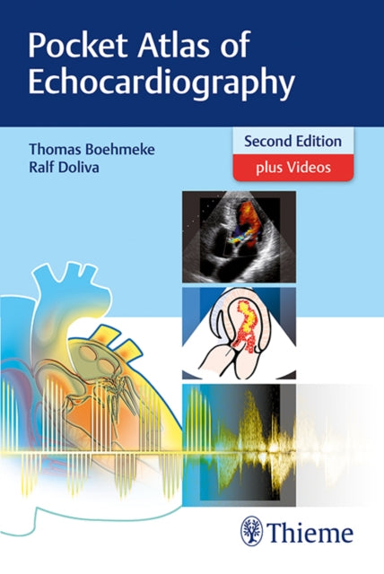 Pocket Atlas of Echocardiography