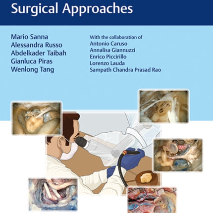 The Temporal Bone: Anatomical Dissection and Surgical Approaches