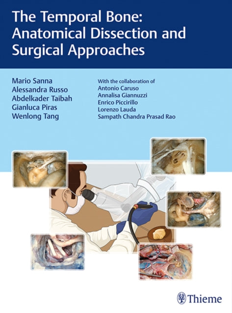 The Temporal Bone: Anatomical Dissection and Surgical Approaches