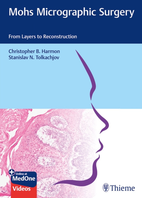 Mohs Micrographic Surgery From Layers to Reconstruction