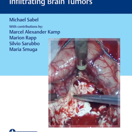 Video Atlas of Neurophysiological Monitoring in Surgery of Infiltrating Brain Tumors