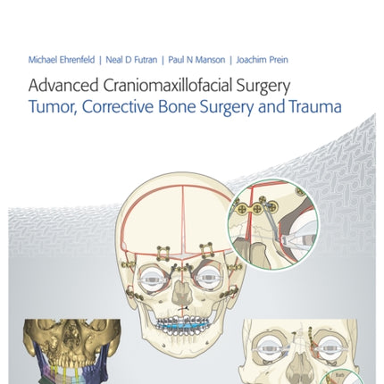 Advanced Craniomaxillofacial Surgery