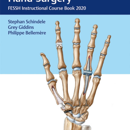 Arthroplasty in Hand Surgery