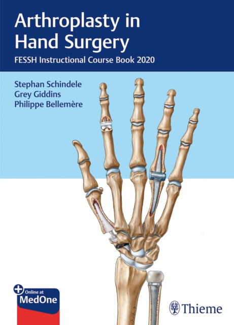 Arthroplasty in Hand Surgery