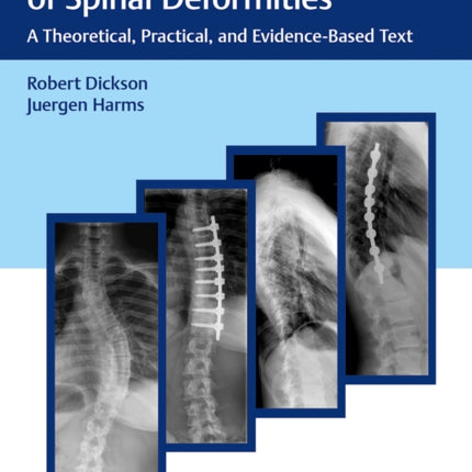 Modern Management of Spinal Deformities: A Theoretical, Practical, and Evidence-Based Text