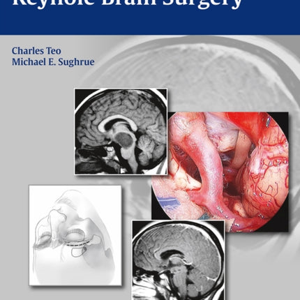 Principles and Practice of Keyhole Brain Surgery