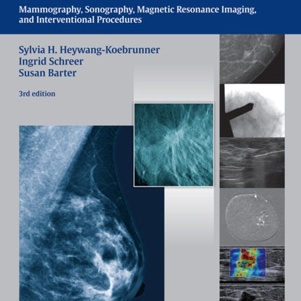 Diagnostic Breast Imaging: Mammography, Sonography, MRI and Interventional Procedures